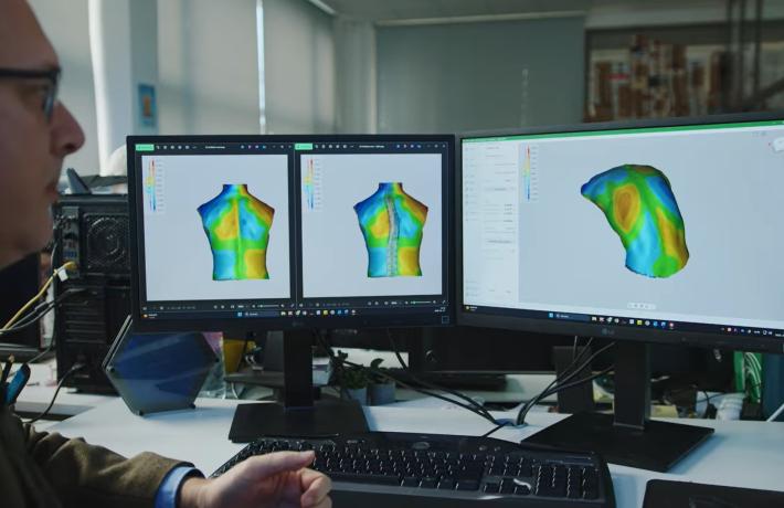 3D testszkennelés az ortopédiában