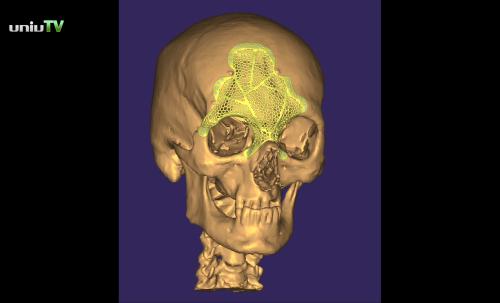 3d arcrekonstrukció