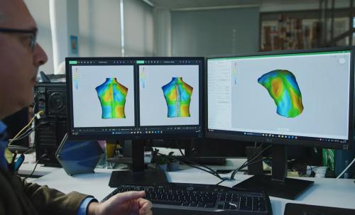 3D testszkennelés az ortopédiában